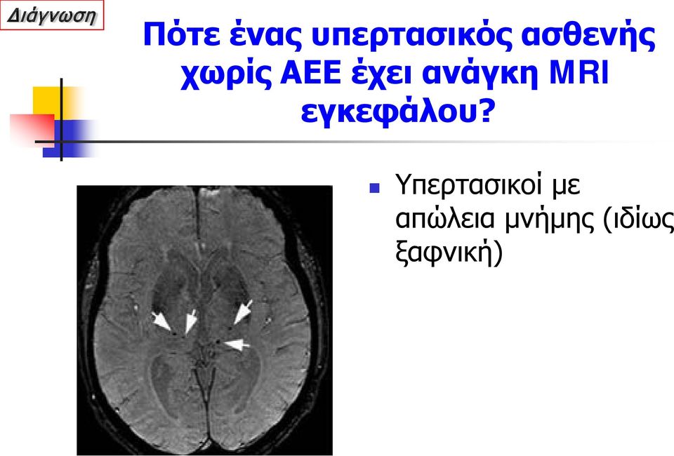 MRI εγκεφάλου?