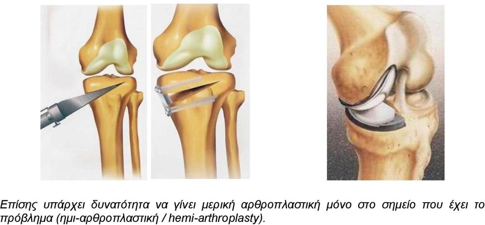 στο σημείο που έχει το πρόβλημα