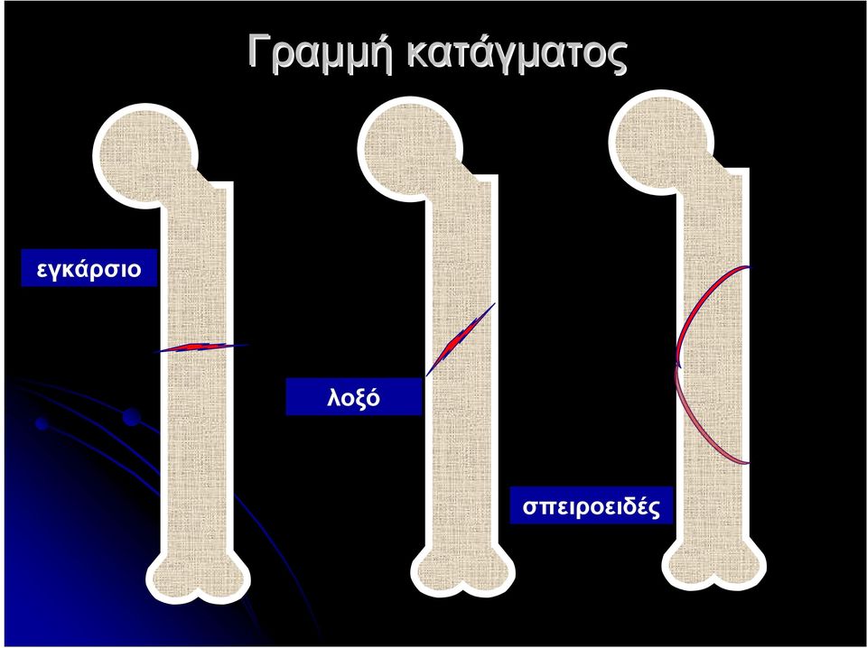 εγκάρσιο