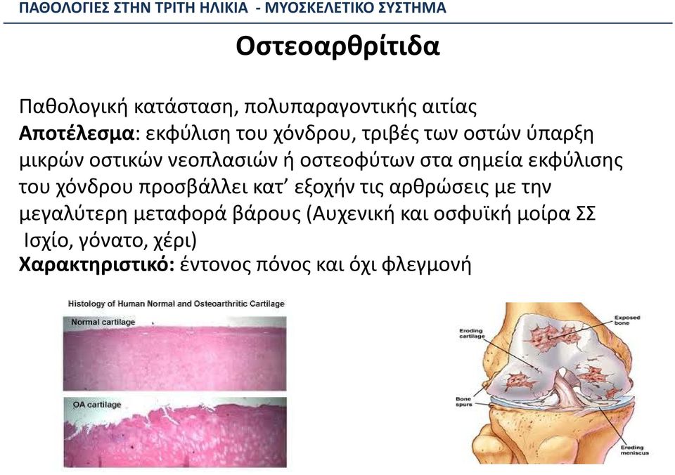 εκφύλισης του χόνδρου προσβάλλει κατ εξοχήν τις αρθρώσεις με την μεγαλύτερη μεταφορά