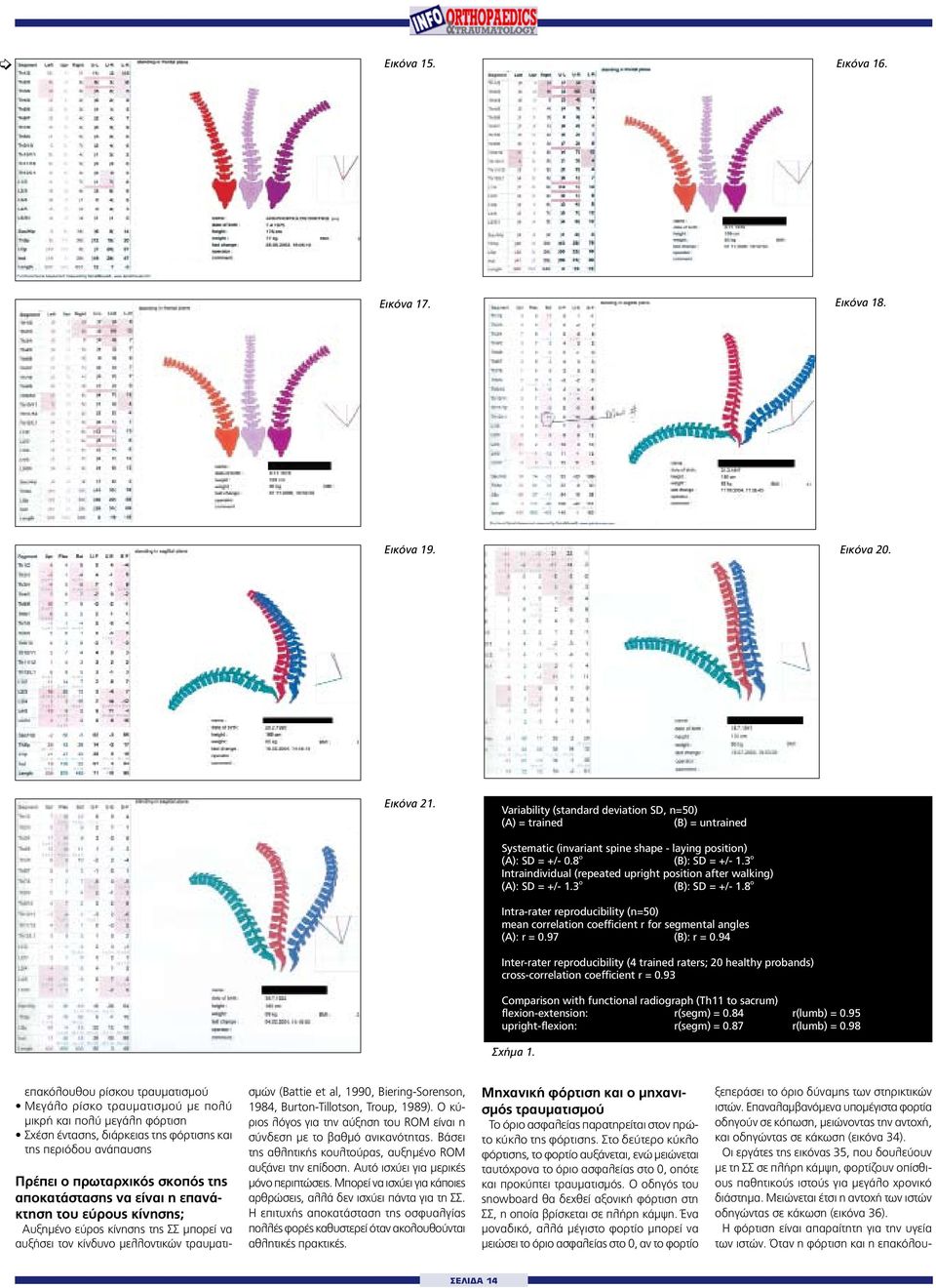 3 o Intraindividual (repeated upright position after walking) (A): SD = +/- 1.3 o (B): SD = +/- 1.8 o Intra-rater reproducibility (n=50) mean correlation coefficient r for segmental angles (A): r = 0.
