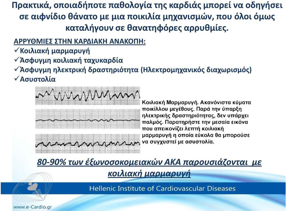 ΑΡΡΥΘΜΙΕΣ ΣΤΗΝ ΚΑΡΔΙΑΚΗ ΑΝΑΚΟΠΗ: Κοιλιακή μαρμαρυγή Άσφυγμη κοιλιακή ταχυκαρδία Άσφυγμη