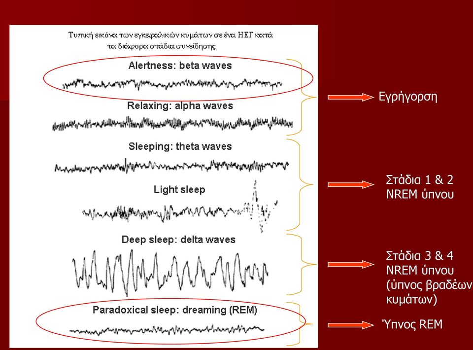 4 NREM ύπνου (ύπνος