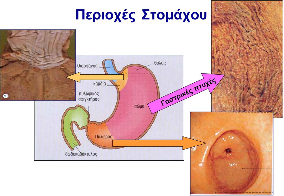 Γαστρικές