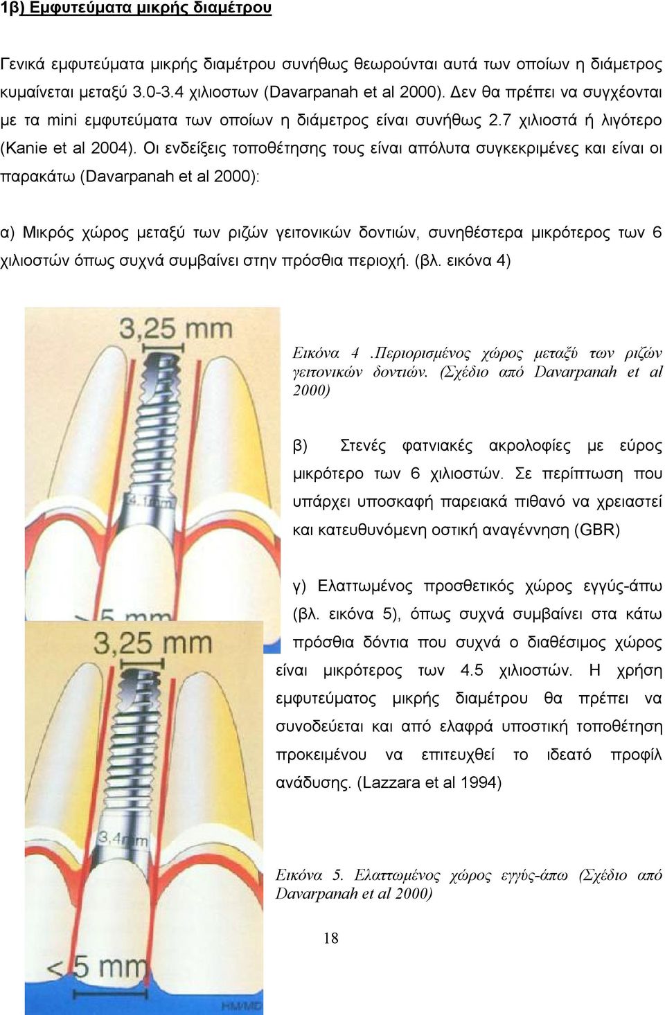 Οι ενδείξεις τοποθέτησης τους είναι απόλυτα συγκεκριμένες και είναι οι παρακάτω (Davarpanah et al 2000): α) Μικρός χώρος μεταξύ των ριζών γειτονικών δοντιών, συνηθέστερα μικρότερος των 6 χιλιοστών