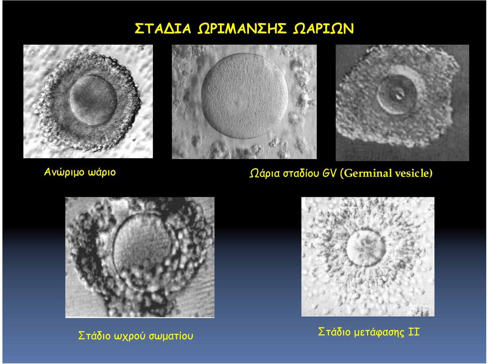 GV (Germinal vesicle) Στάδιο