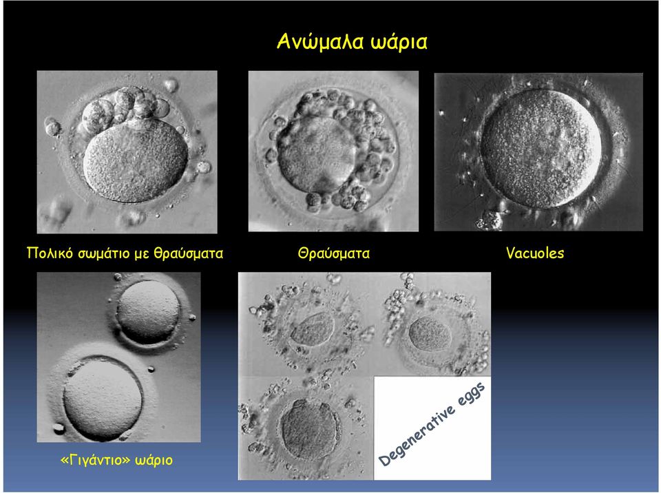 Θραύσματα Vacuoles