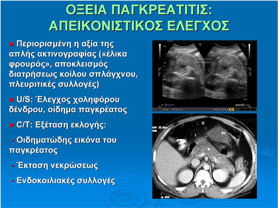 πλευριτικές συλλογές) U/S: Έλεγχος χοληφόρου δένδρου, οίδημα παγκρέατος C/T: