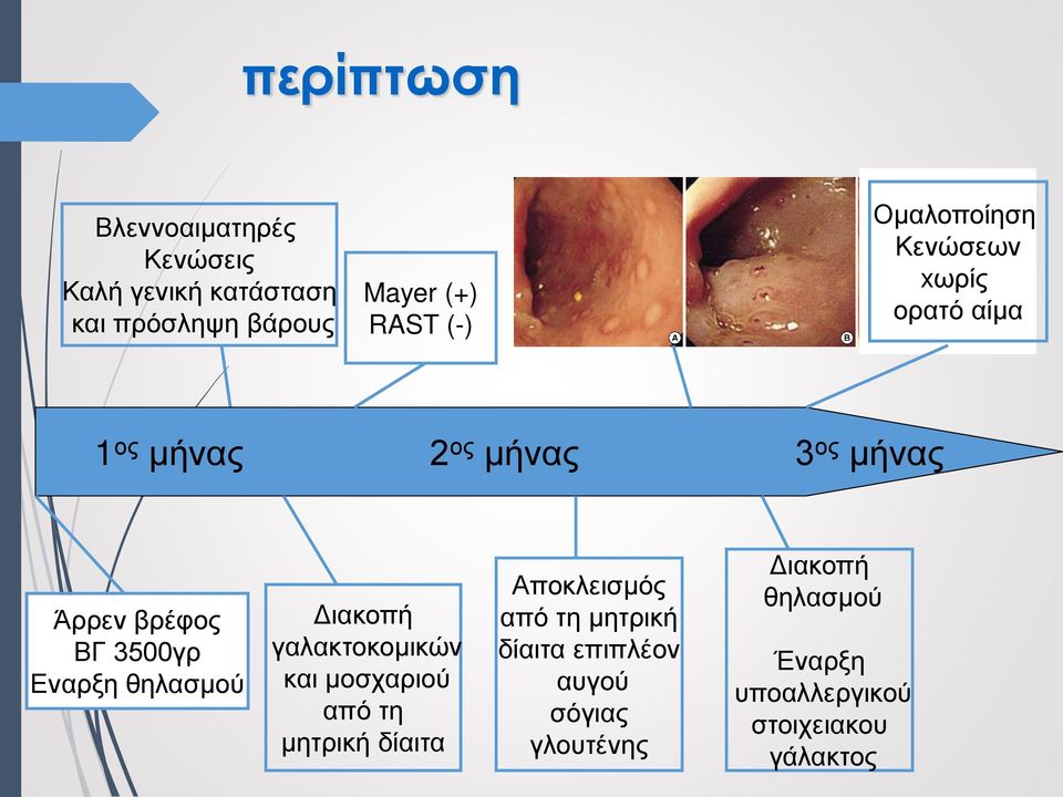 Εναρξη θηλασμού Διακοπή γαλακτοκομικών και μοσχαριού από τη μητρική δίαιτα Αποκλεισμός από τη