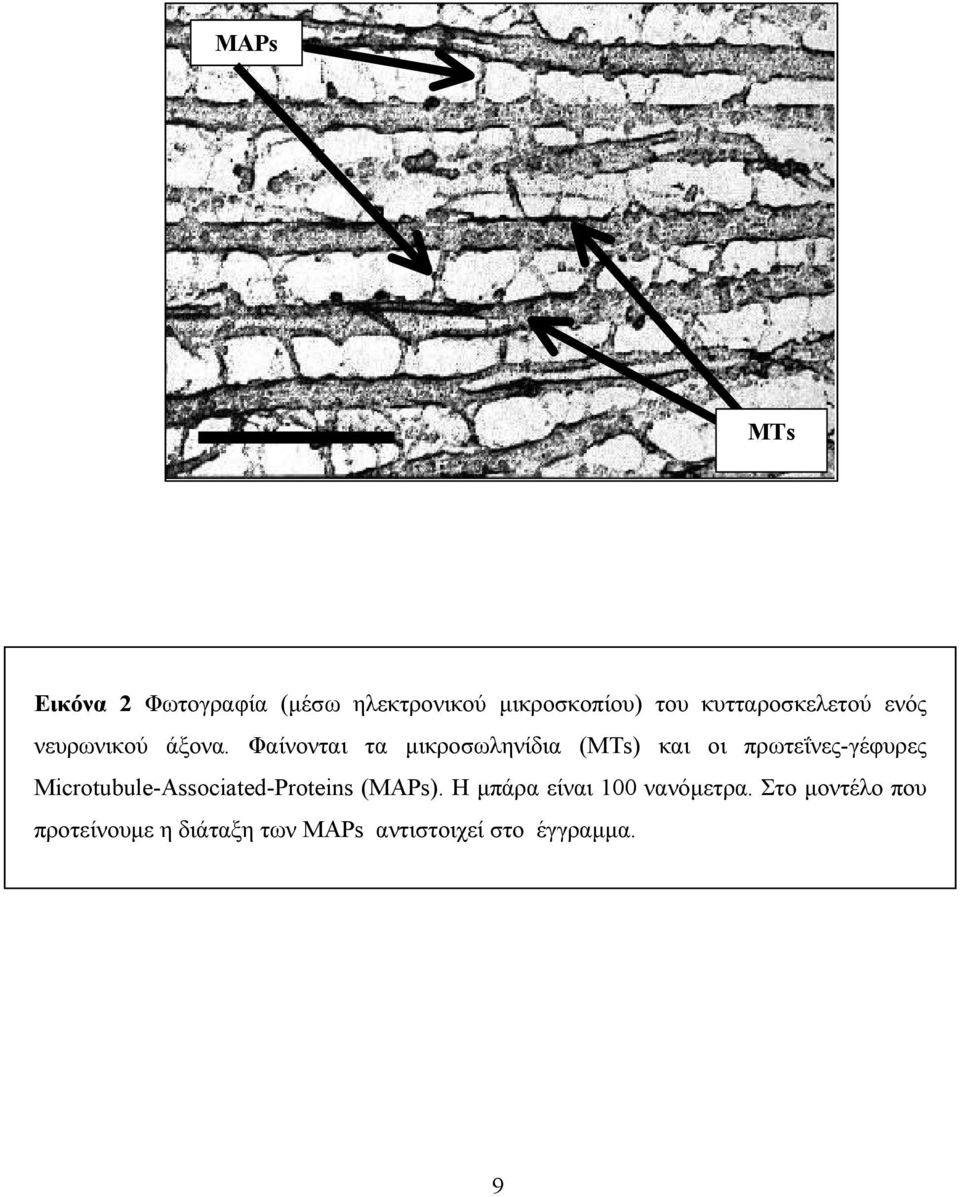 Φαίνονται τα µικροσωληνίδια (ΜΤs) και οι πρωτεΐνες-γέφυρες