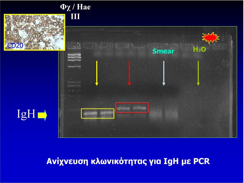 Ανίχνευση