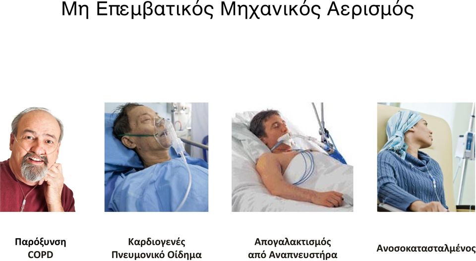 Καρδιογενές Πνευμονικό Οίδημα