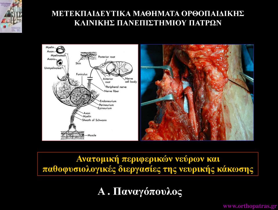 περιφερικών νεύρων και παθοφυσιολογικές