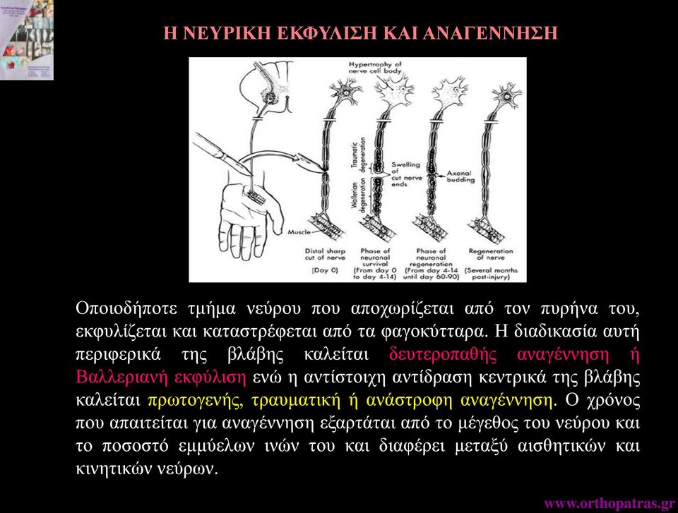 Η διαδικασία αυτή περιφερικά της βλάβης καλείται δευτεροπαθής αναγέννηση ή Βαλλεριανή εκφύλιση ενώ η αντίστοιχη αντίδραση