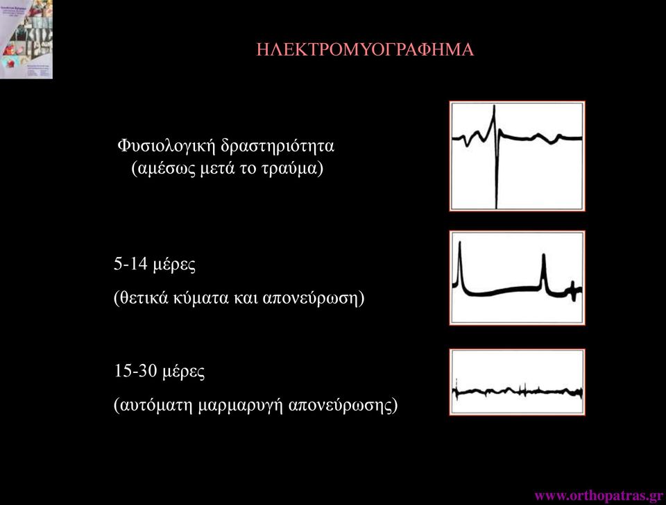 5-14 μέρες (θετικά κύματα και