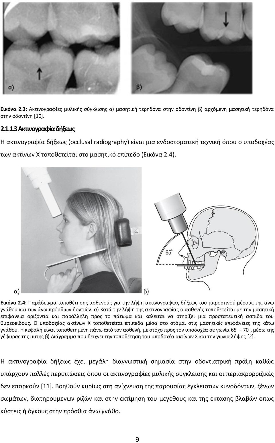 α) β) Εικόνα 2.4: Παράδειγμα τοποθέτησης ασθενούς για την λήψη ακτινογραφίας δήξεως του μπροστινού μέρους της άνω γνάθου και των άνω πρόσθιων δοντιών.