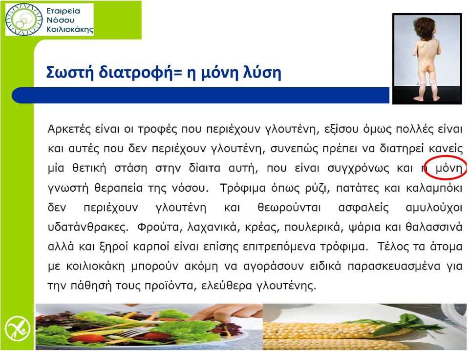 η μόνη