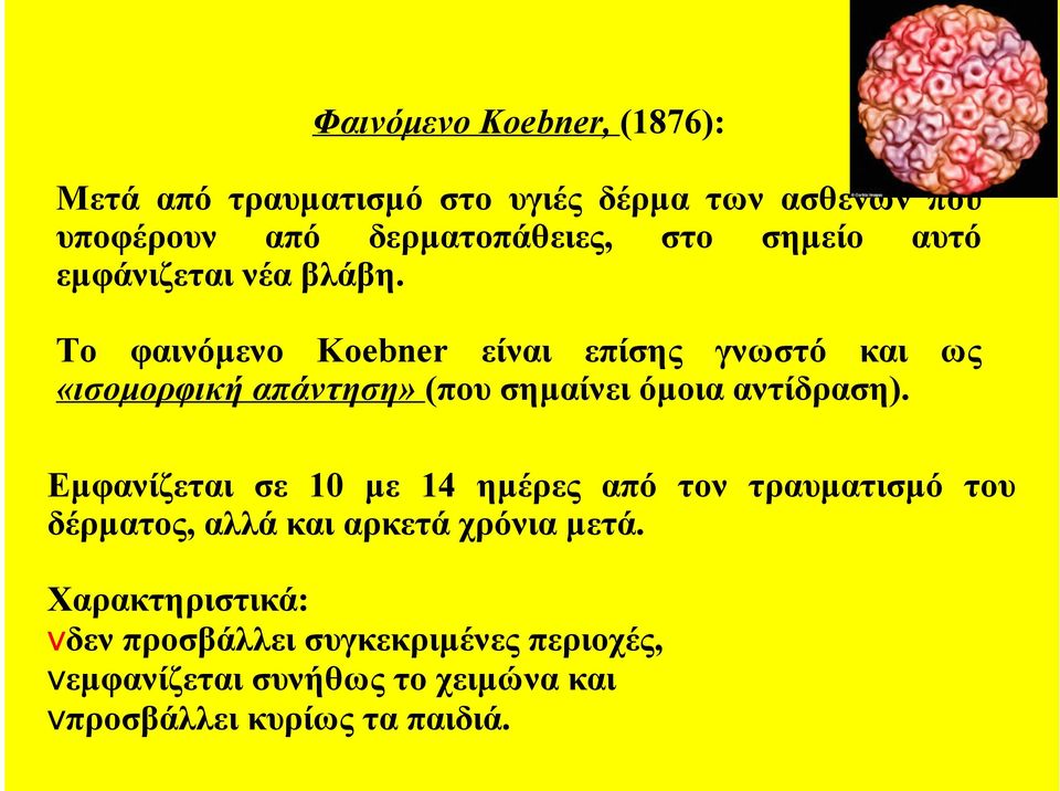 Το φαινόµενο Koebner είναι επίσης γνωστό και ως «ισοµορφική απάντηση» (που σηµαίνει όµοια αντίδραση).