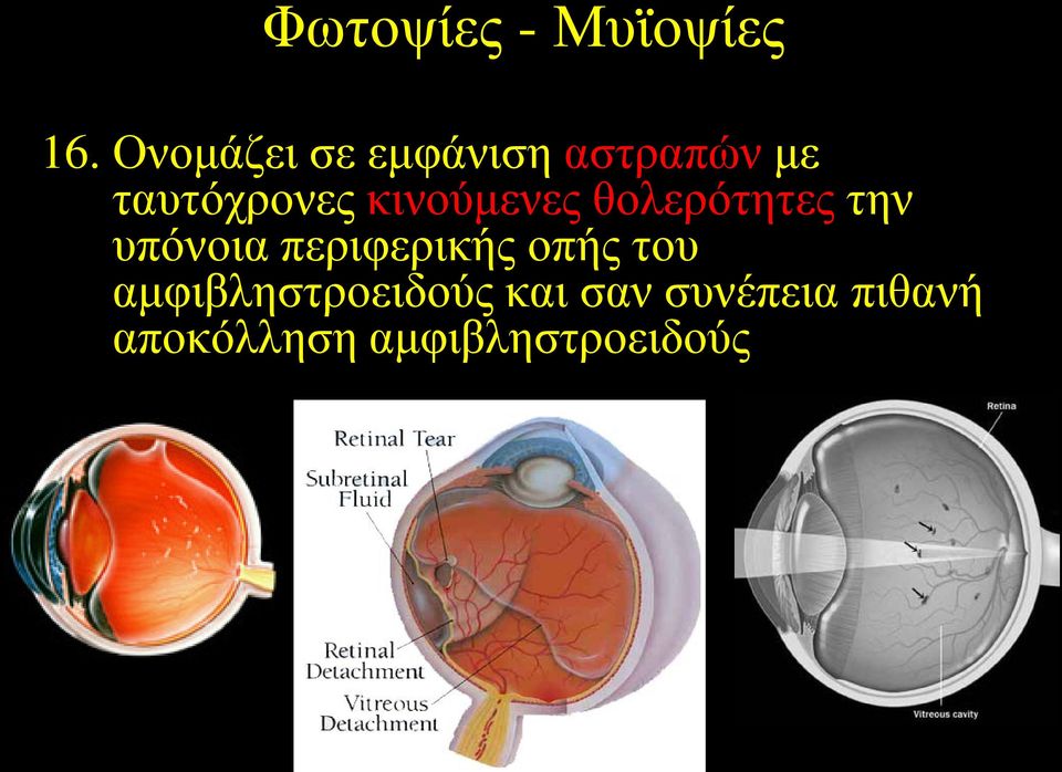 κινούμενες θολερότητες την υπόνοια περιφερικής