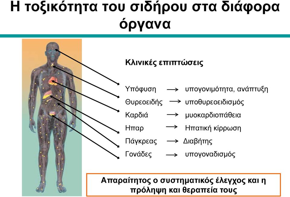 ανάπτυξη υποθυρεοειδισμός μυοκαρδιοπάθεια Ηπατική κίρρωση Διαβήτης