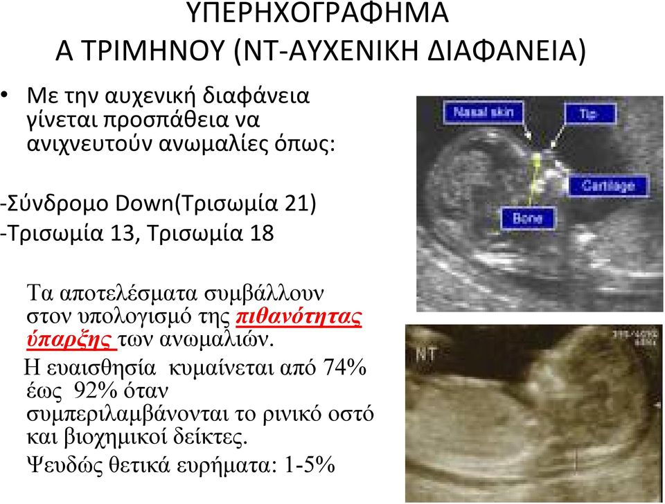 συμβάλλουν στον υπολογισμό της πιθανότητας ύπαρξης των ανωμαλιών.
