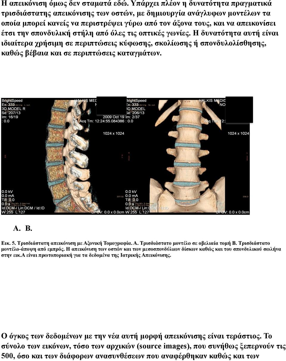 σπονδυλική στήλη από όλες τις οπτικές γωνίες. Η δυνατότητα αυτή είναι ιδιαίτερα χρήσιµη σε περιπτώσεις κύφωσης, σκολίωσης ή σπονδυλολίσθησης, καθώς βέβαια και σε περιπτώσεις καταγµάτων. A. B. Εικ. 5.