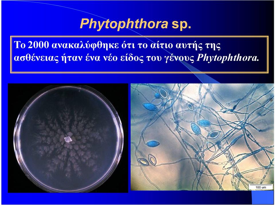 αίτιο αυτής της ασθένειας