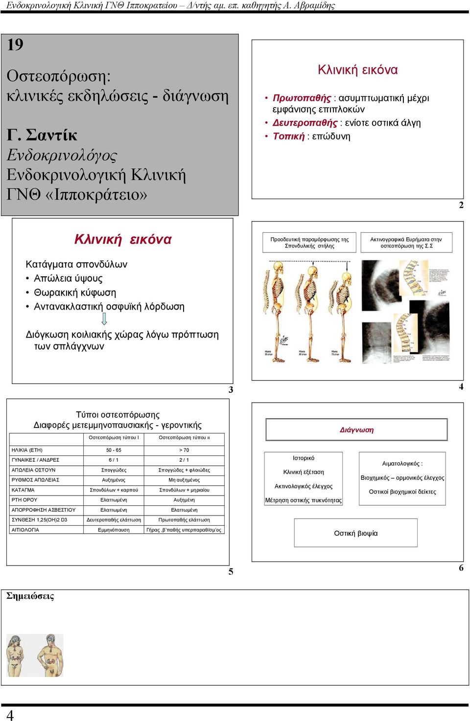 Κατάγµατα σπονδύλων Απώλεια ύψους Θωρακική κύφωση Αντανακλαστική οσφυϊκή λόρδωση Προοδευτική παραµόρφωσης της Σπονδυλικής στήλης Ακτινογραφικά Ευρήµατα στην οστεοπόρωση της Σ.