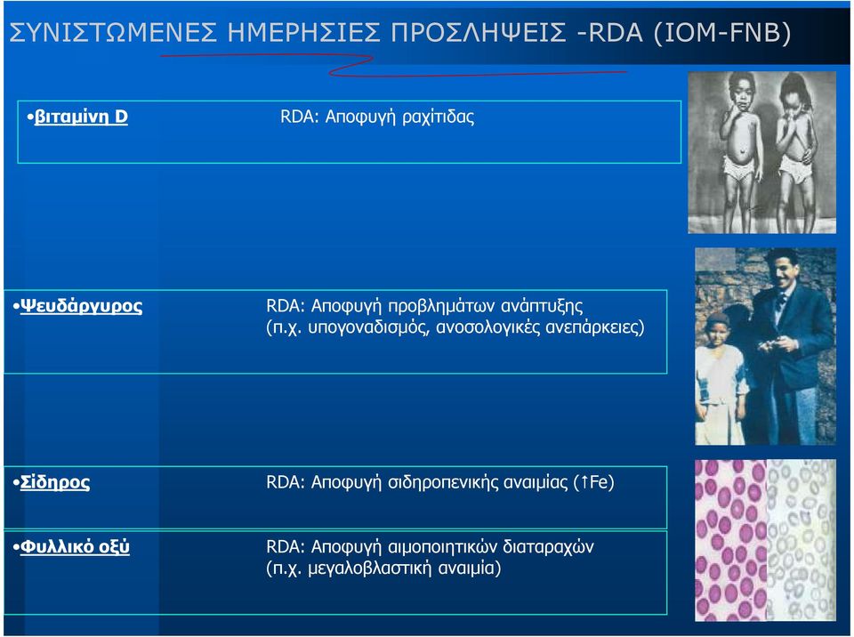 υπογοναδισµός, ανοσολογικές ανεπάρκειες) Σίδηρος RDA: Αποφυγή σιδηροπενικής