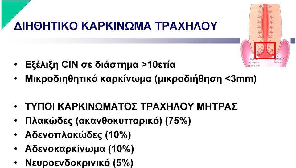 ΚΑΡΚΙΝΩΜΑΤΟΣ ΤΡΑΧΗΛΟΥ ΜΗΤΡΑΣ Πλακώδες (ακανθοκυτταρικό)