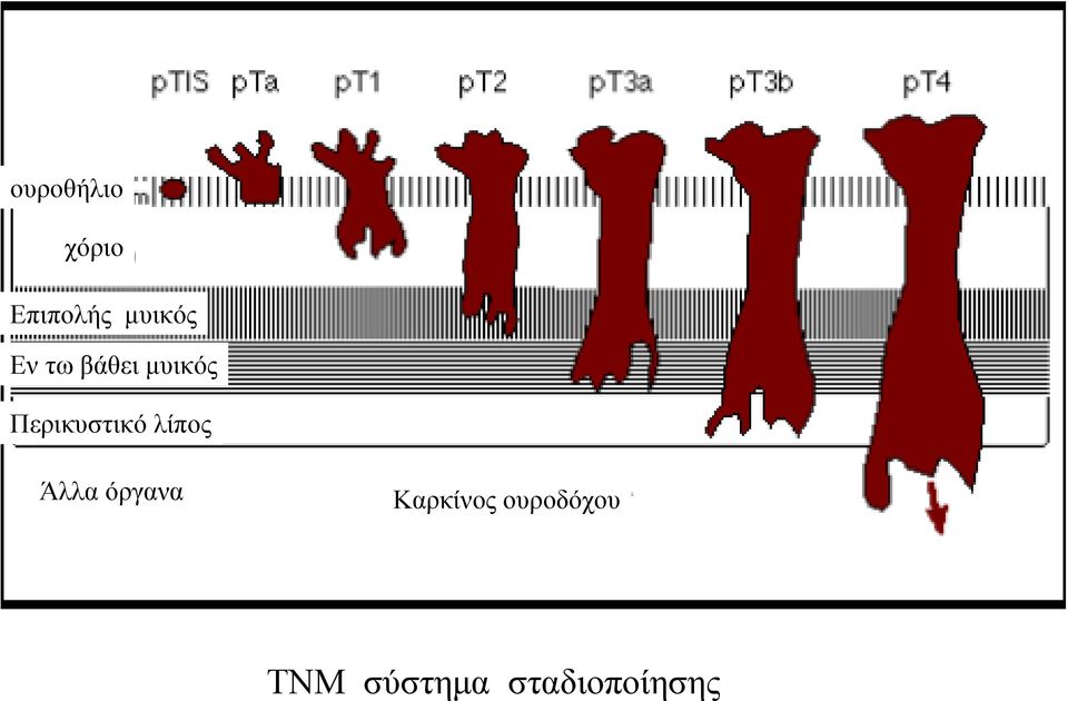 λίπος Άλλα όργανα Καρκίνος