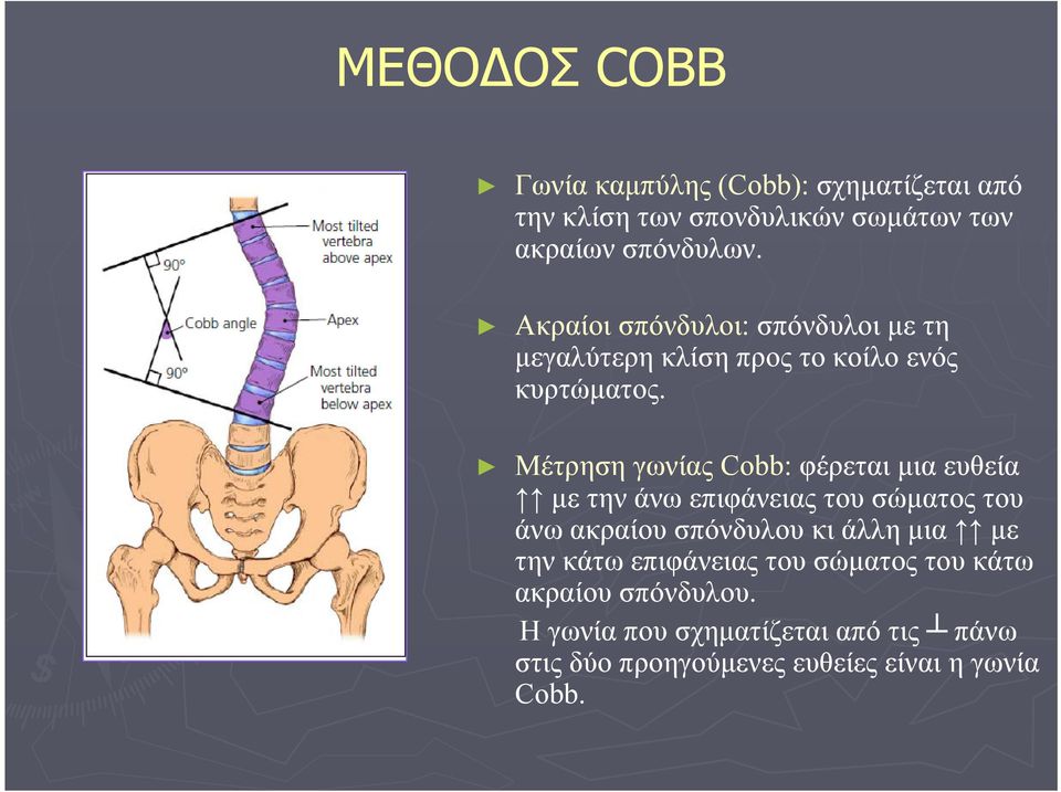 Μέτρηση γωνίας Cobb: φέρεται μια ευθεία με την άνω επιφάνειας του σώματος του άνω ακραίου σπόνδυλου κι άλλη μια