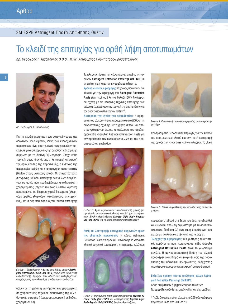 Τασόπουλος Για την ακριβή αποτύπωση των αυχενικών ορίων των οδοντικών κολοβωμάτων, ιδίως των ενδοσχισμικών παρασκευών είναι επιστημονικά τεκμηριωμένες ποικίλες τεχνικές διεύρυνσης της ουλοδοντικής