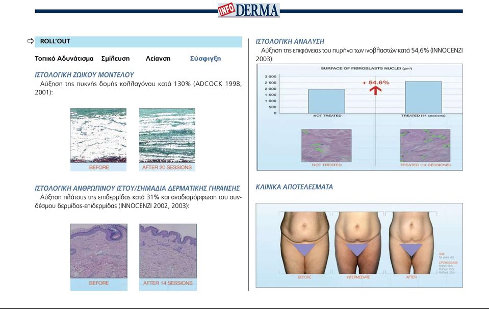 (ADCOCK 1998, 2001): Ιστολογικη ΑΝΘΡΩΠΙΝΟΥ ΙΣΤΟΥ/ΣΗΜΑΔΙΑ ΔΕΡΜΑΤΙΚΗΣ ΓΗΡΑΝΣΗΣ Αύξηση πλάτους