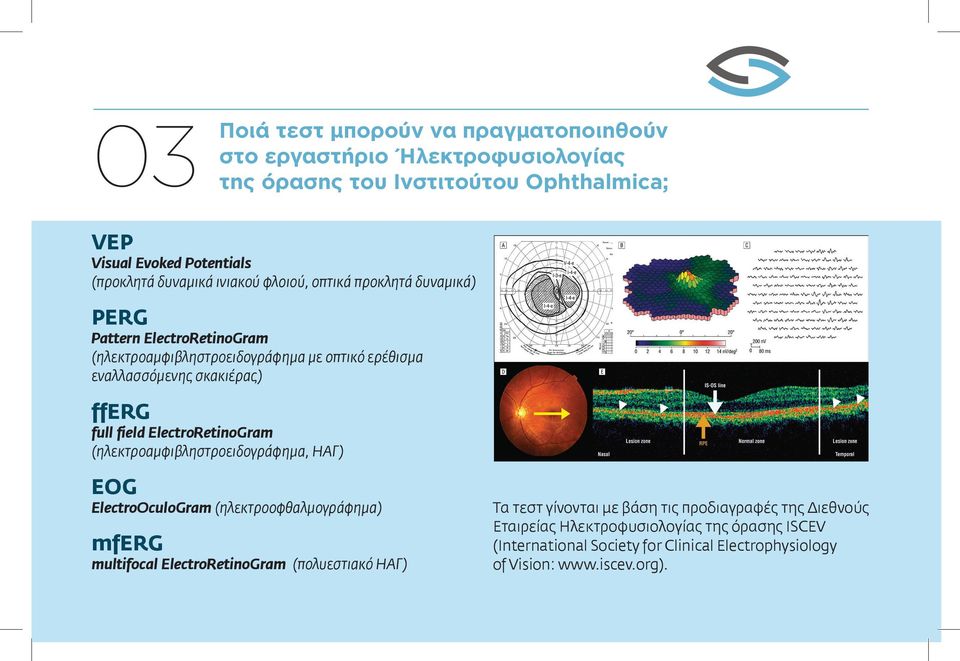 ElectroRetinoGram (ηλεκτροαμφιβληστροειδογράφημα, ΗΑΓ) EOG ElectroOculoGram (ηλεκτροοφθαλμογράφημα) mferg multifocal ElectroRetinoGram (πολυεστιακό ΗΑΓ) Τα τεστ