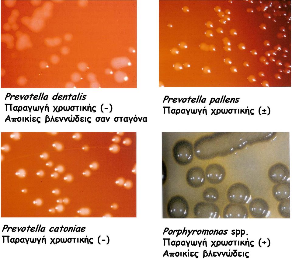 χρωστικής (±) Prevotella catoniae Παραγωγή χρωστικής