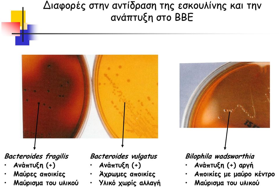 Bacteroides vulgatus Ανάπτυξη (+) Άχρωμες αποικίες Υλικό χωρίς αλλαγή