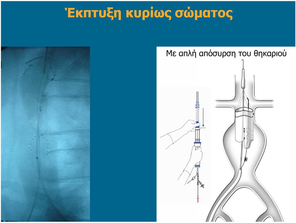 σώµατος Με