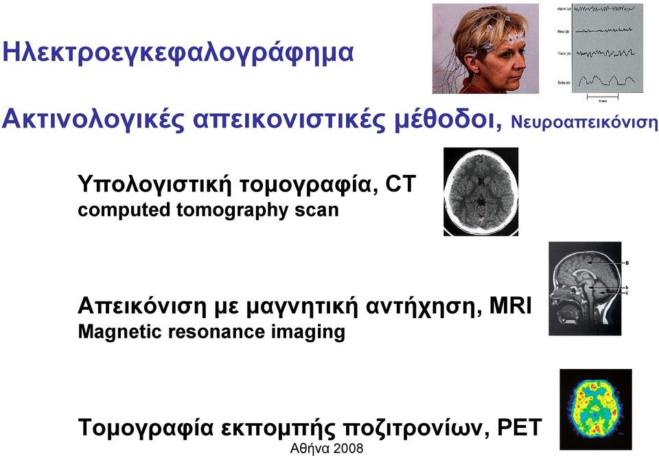 computed tomography scan Απεικόνιση με μαγνητική