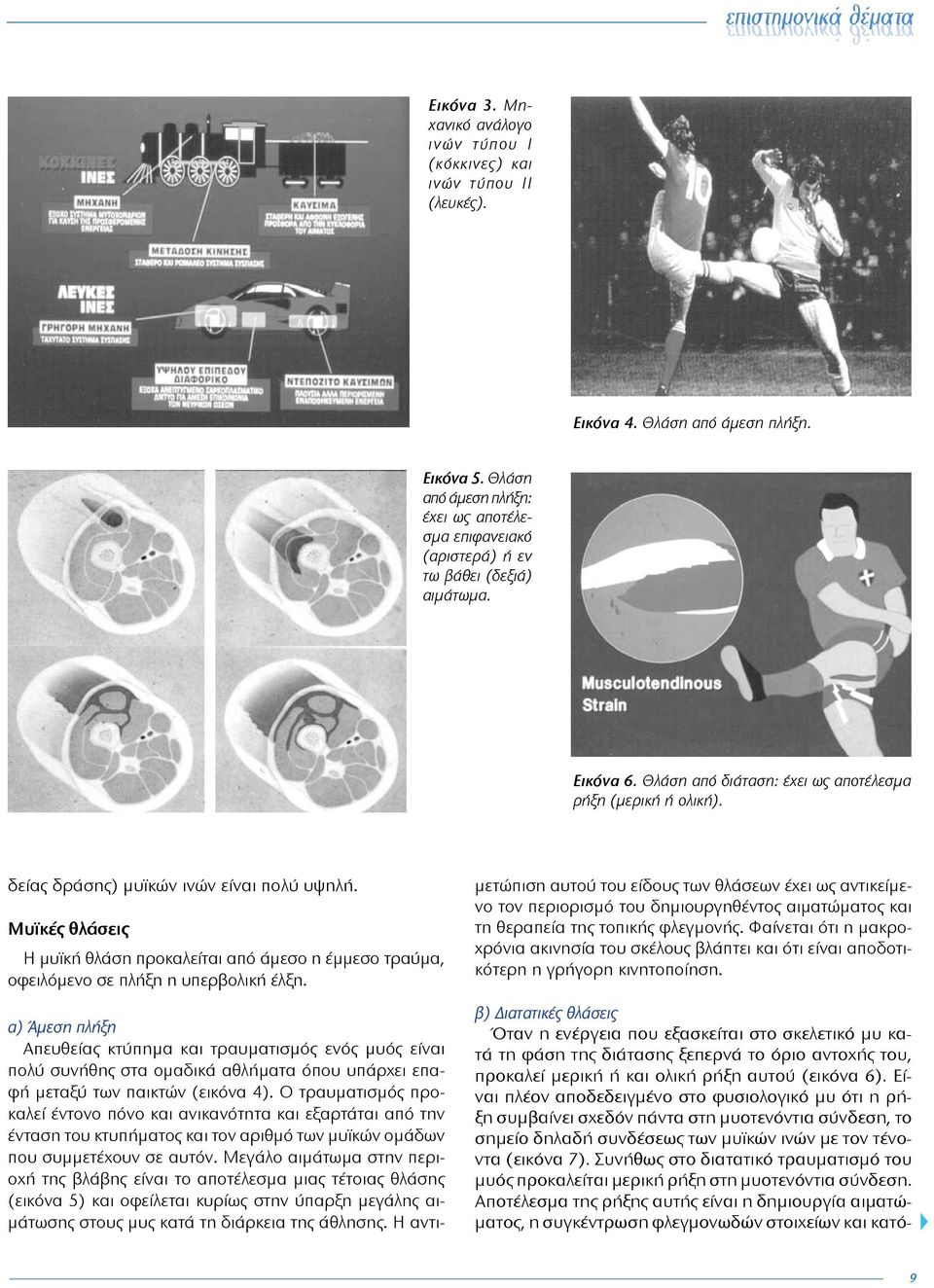 δείας δράσης) μυϊκών ινών είναι πολύ υψηλή. Μυϊκές θλάσεις Η μυϊκή θλάση προκαλείται από άμεσο η έμμεσο τραύμα, οφειλόμενο σε πλήξη η υπερβολική έλξη.