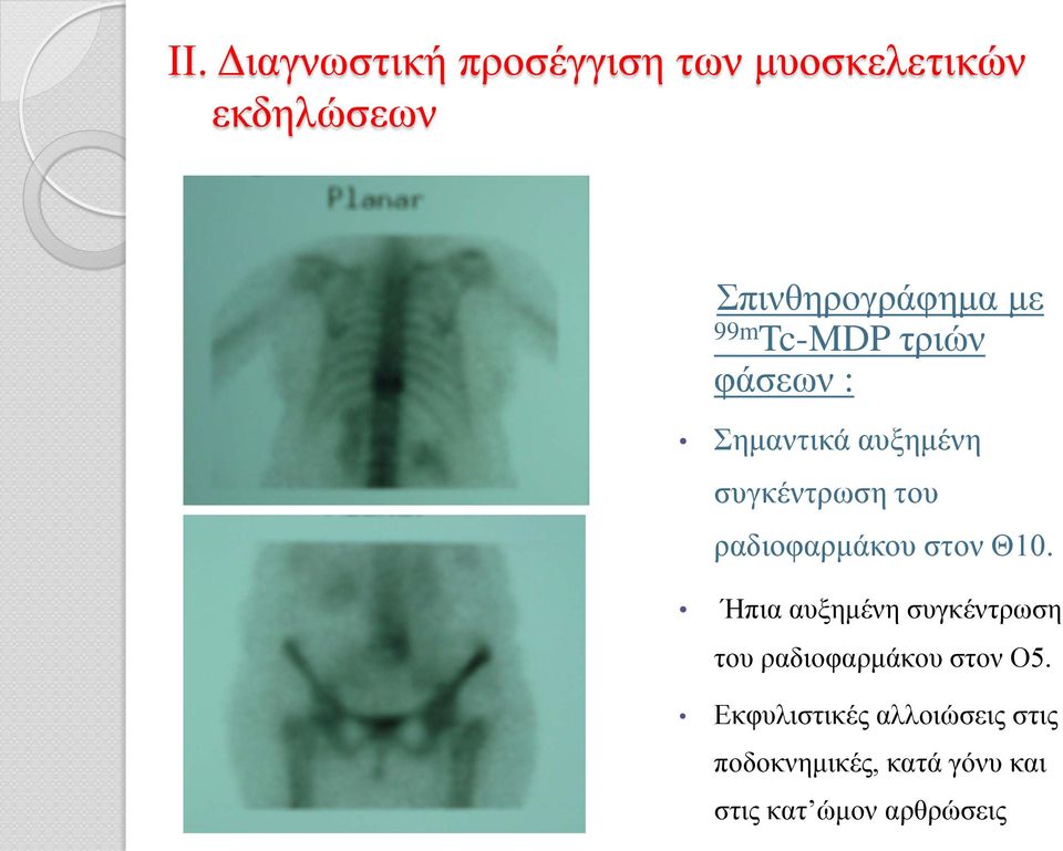 ραδιοφαρμάκου στον Θ10.