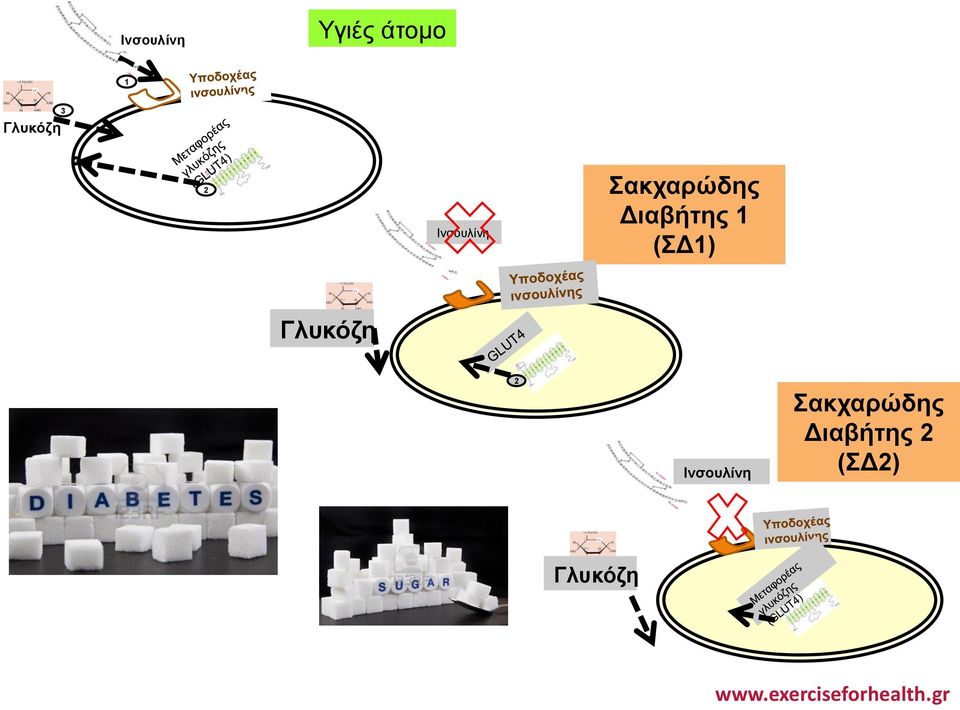 Διαβήτης 1 (ΣΔ1) Γλυκόζη 2