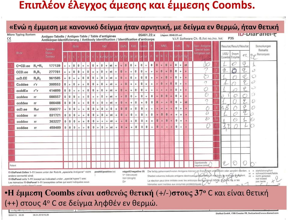 εν θερμώ, ήταν θετική Η έμμεση Coombs είναι ασθενώς θετική