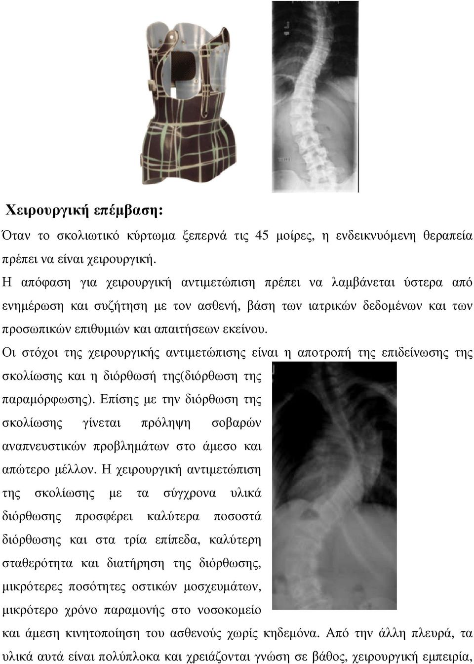 Οι στόχοι της χειρουργικής αντιµετώπισης είναι η αποτροπή της επιδείνωσης της σκολίωσης και η διόρθωσή της(διόρθωση της παραµόρφωσης).