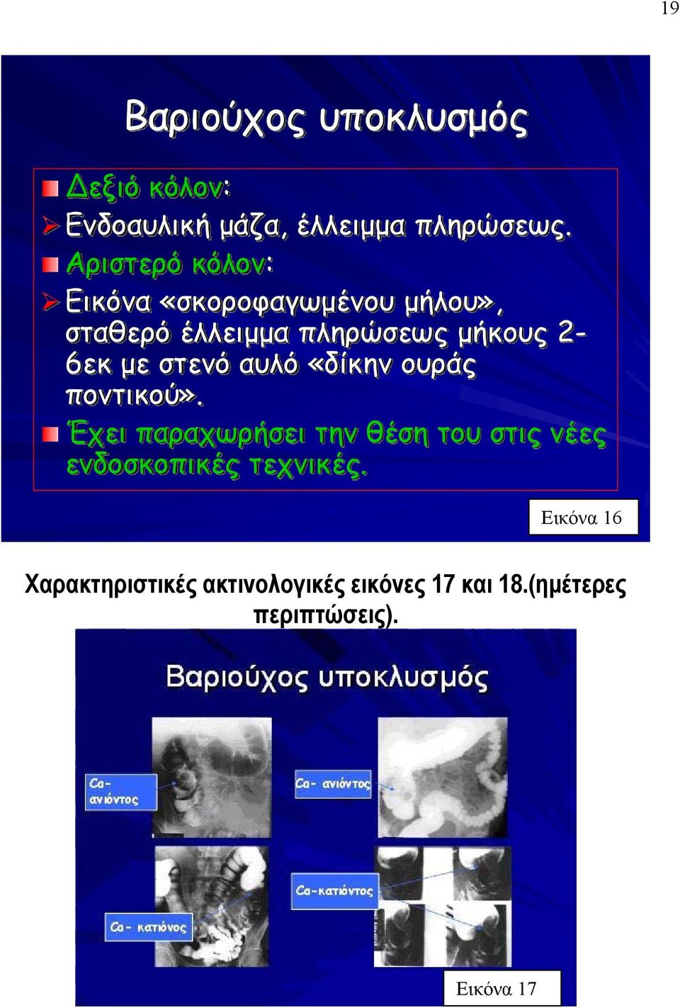 με στενό αυλό «δίκην ουράς ποντικού».