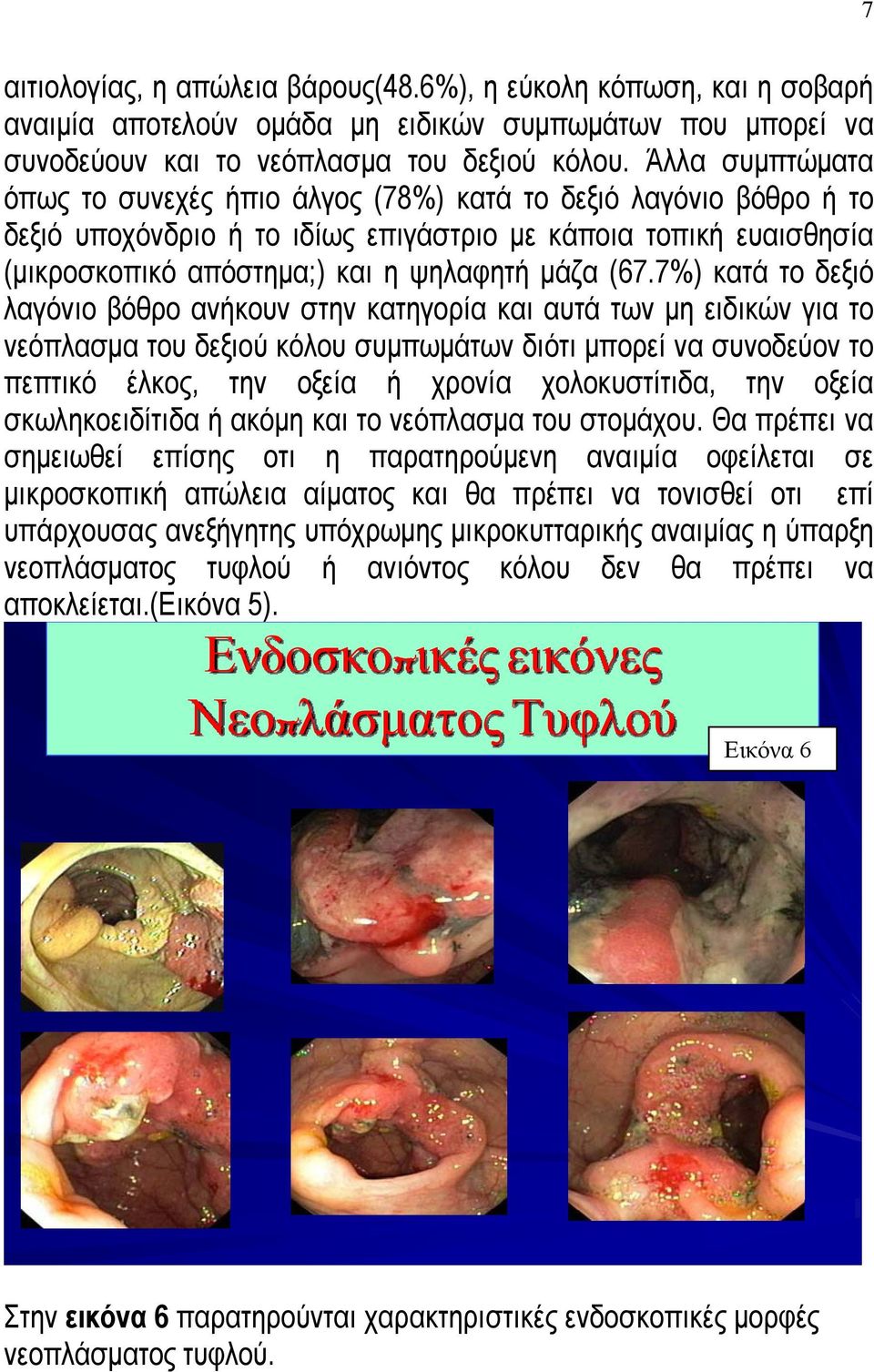 7%) κατά το δεξιό λαγόνιο βόθρο ανήκουν στην κατηγορία και αυτά των μη ειδικών για το νεόπλασμα του δεξιού κόλου συμπωμάτων διότι μπορεί να συνοδεύον το πεπτικό έλκος, την οξεία ή χρονία