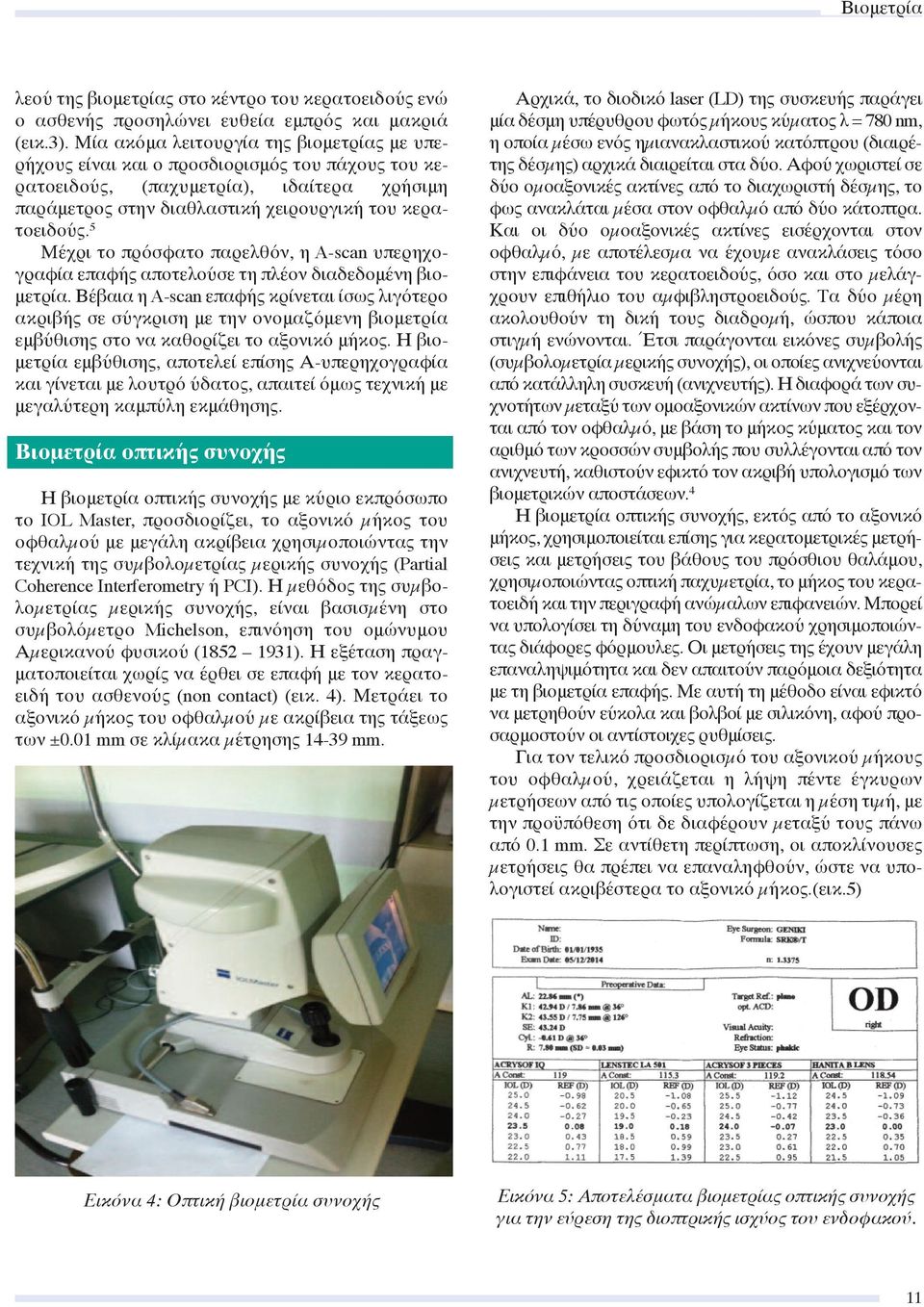 5 Μέχρι το πρόσφατο παρελθόν, η A-scan υπερηχογραφία επαφής αποτελούσε τη πλέον διαδεδομένη βιομετρία.