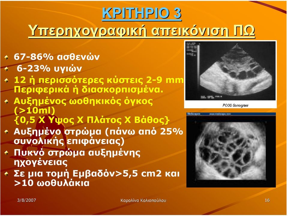 Αυξηµένος ωοθηκικός όγκος (>10ml) {0,5 Χ Υψος Χ Πλάτος Χ Βάθος} Αυξηµένο στρώµα (πάνω από