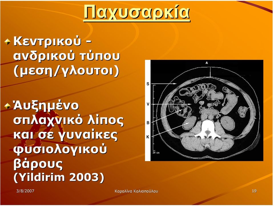 σπλαχνικό λίπος και σε γυναίκες