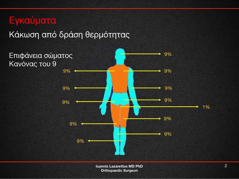 σώματος Κανόνας του 9 9%